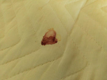 血液　汚れ　落とす