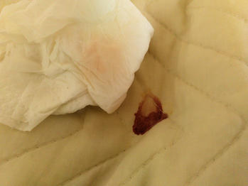 血液　汚れ　落とす